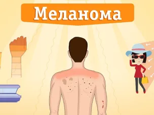 Профилактика меланомы