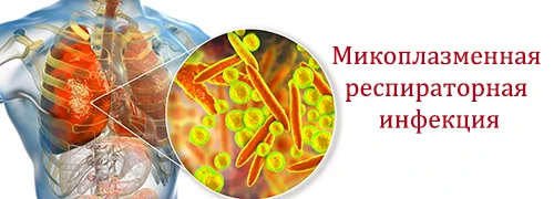Микоплазменная респираторная инфекция: чем опасна?